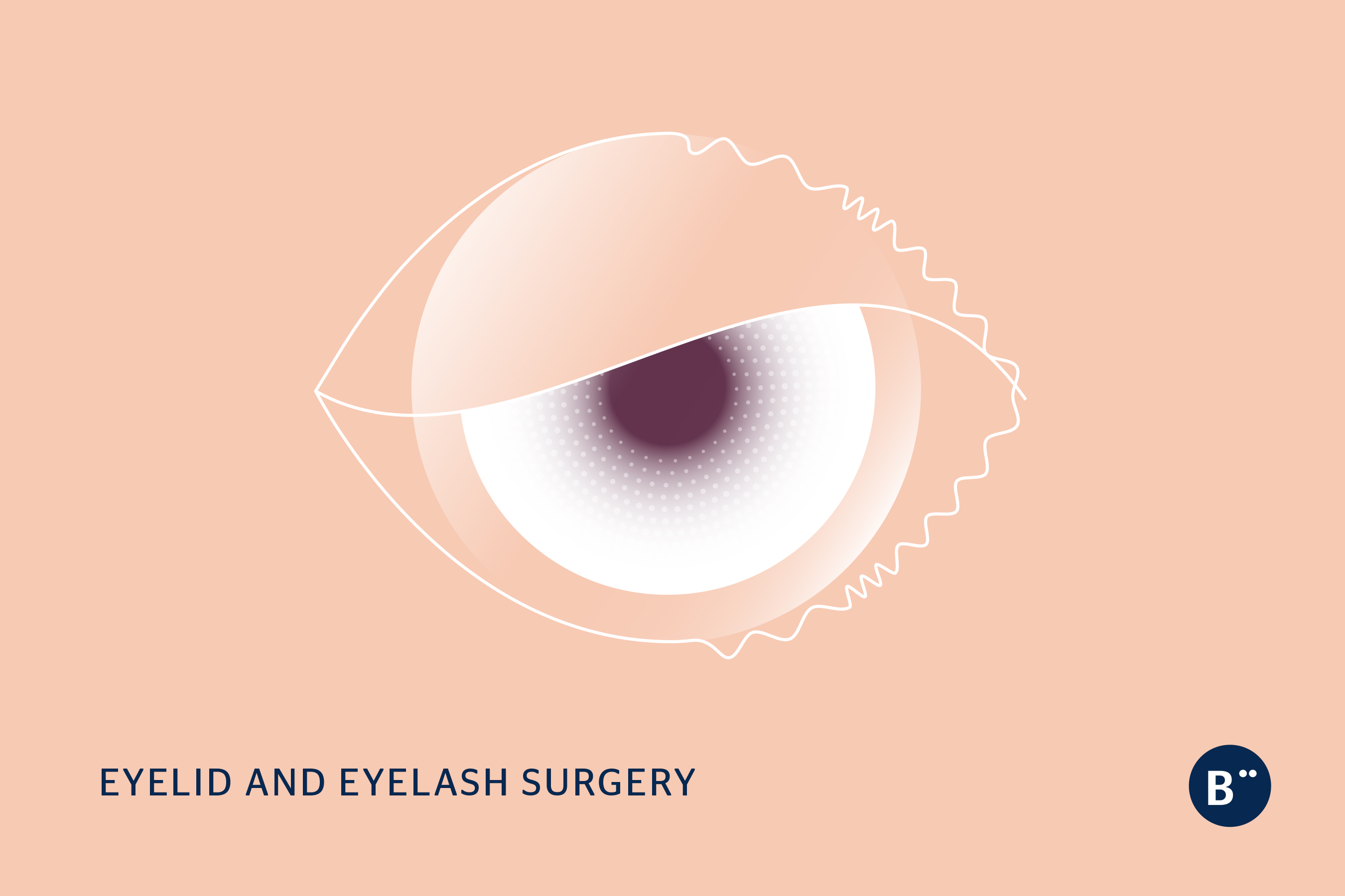 dr_bohm_eyelid_eyelash