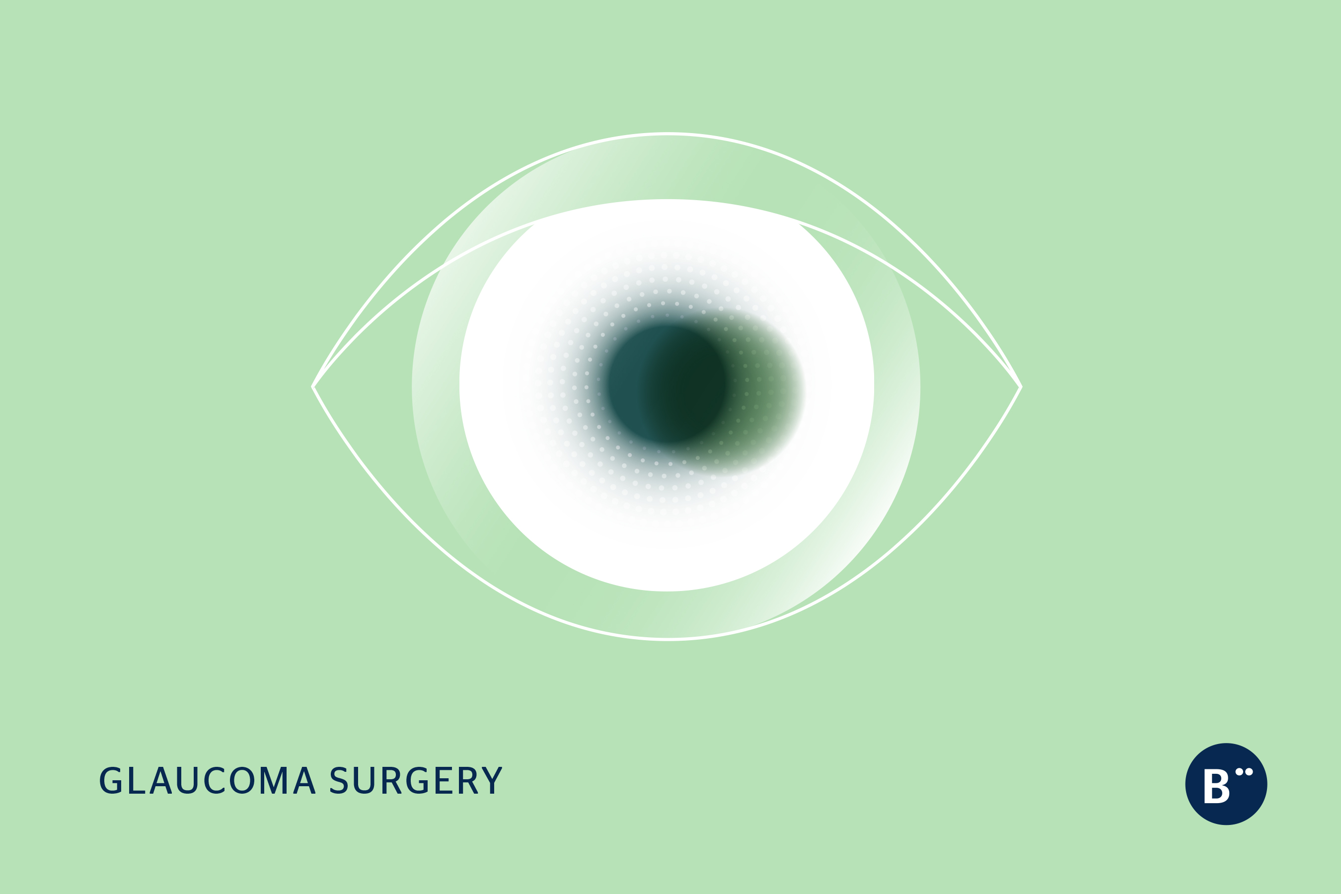 dr_bohm_glaucoma